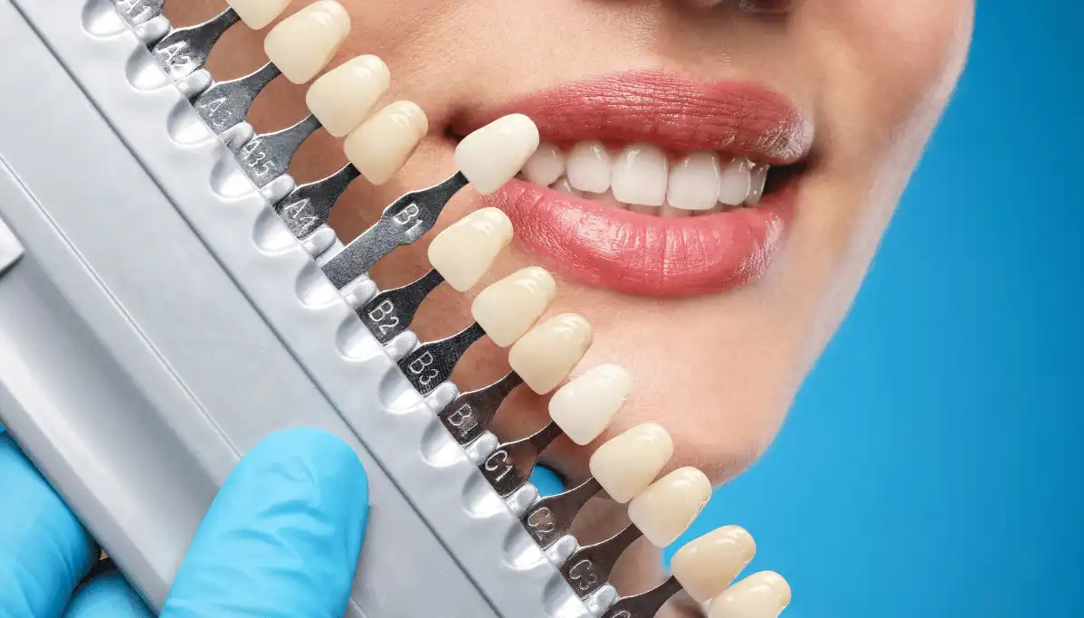 Cosmetic dentistry